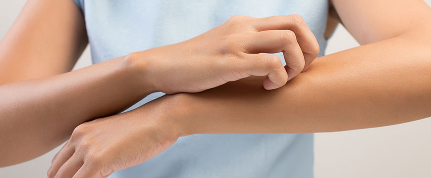 Alleviating Skin Allergies